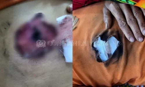 Bắn vợ bằng súng kíp vì không chịu gói bánh ăn để rằm